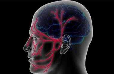 Вазоневральный конфликт на МРТ