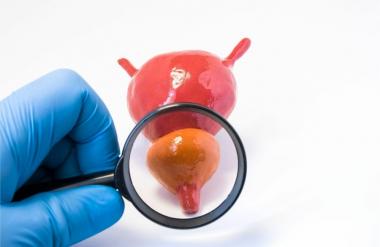 Магнитно-резонансная томография простаты (МРТ предстательной железы)