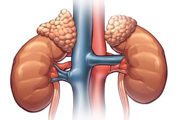 КТ (компьютерная томография) надпочечников