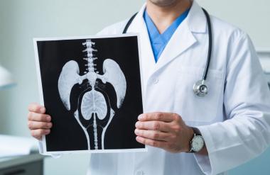 Подготовка к КТ органов малого таза