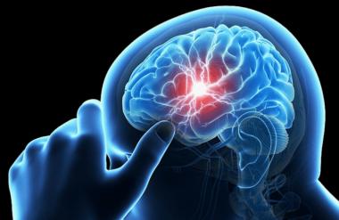 Признаки болезней головного мозга
