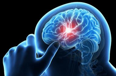 Признаки болезней головного мозга
