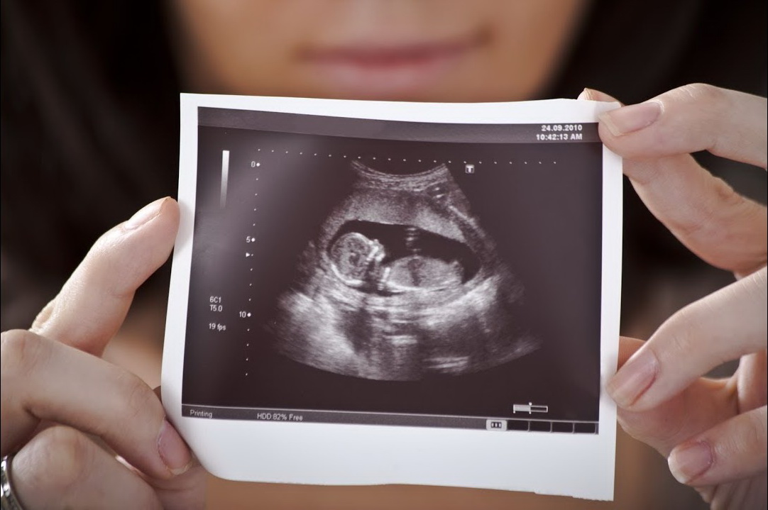 УЗИ при беременности в 1 триместре - снимки