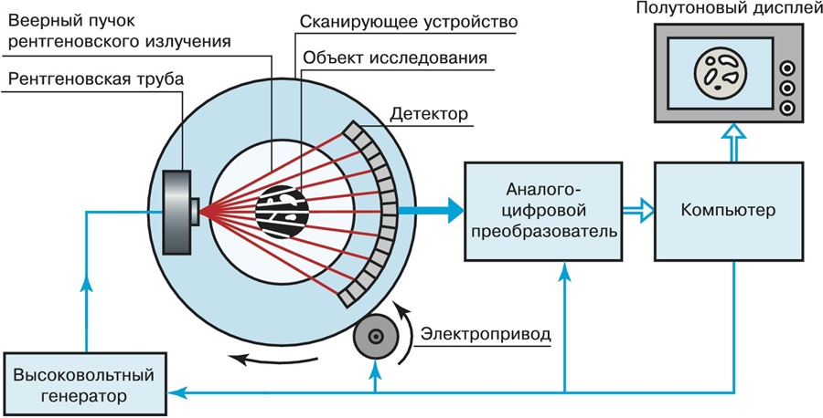 Схема устройства компьютерного томографа