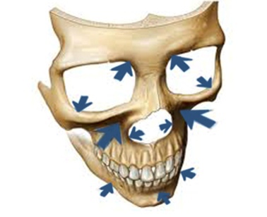 КТ костей лицевого черепа - показания
