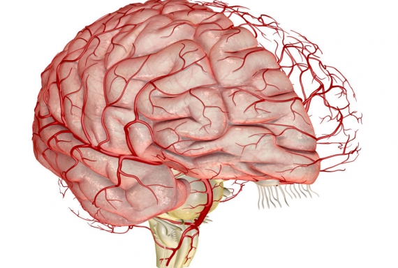 КТ головного мозга и сосудов - показания