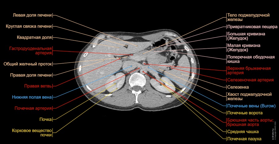Расположение органов брюшной полости на КТ снимке