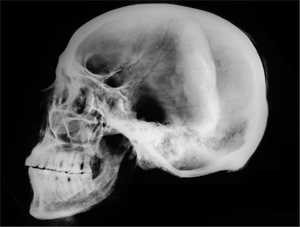 Рентген черепа - снимки