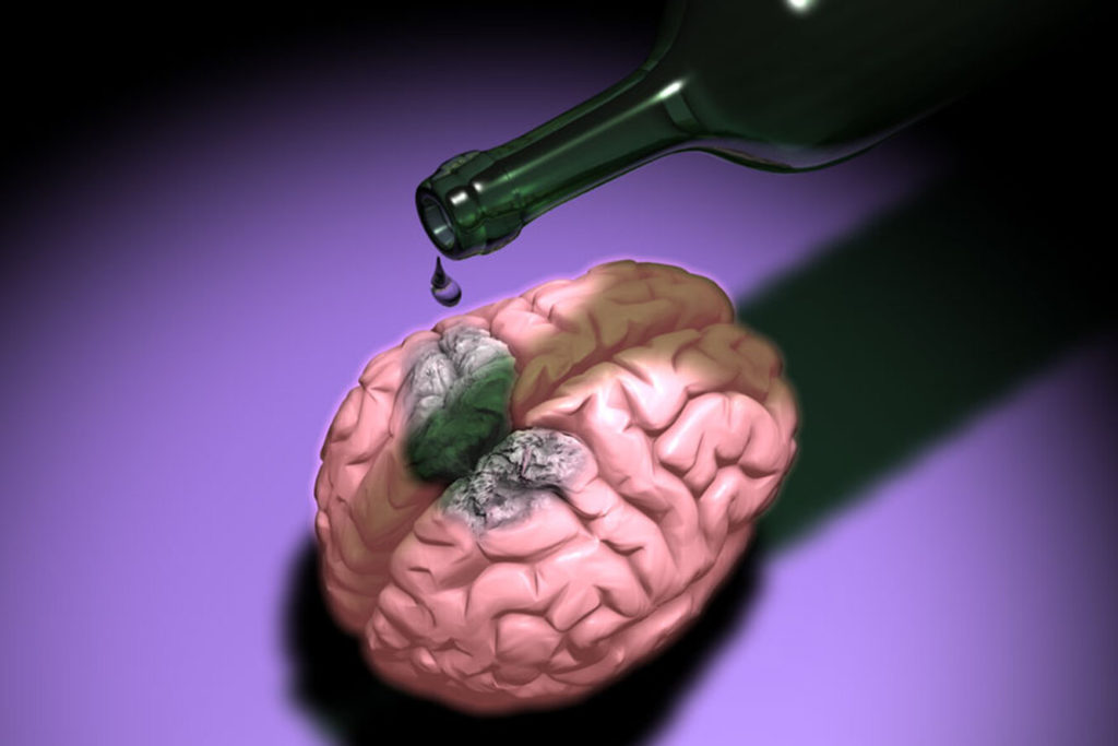 МРТ сосудов головного мозга - влияние алкоголя