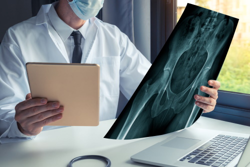 Рентген тазобедренного сустава - расшифровка снимков