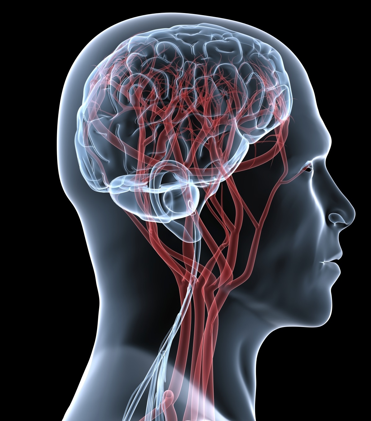 МРТ мозга, сосудов головы и шеи - показания