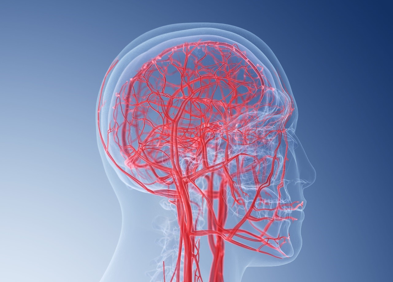 МР-ангиографию сосудов мозга и шеи - показания