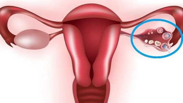 КТ органов малого таза - что видно у женщин