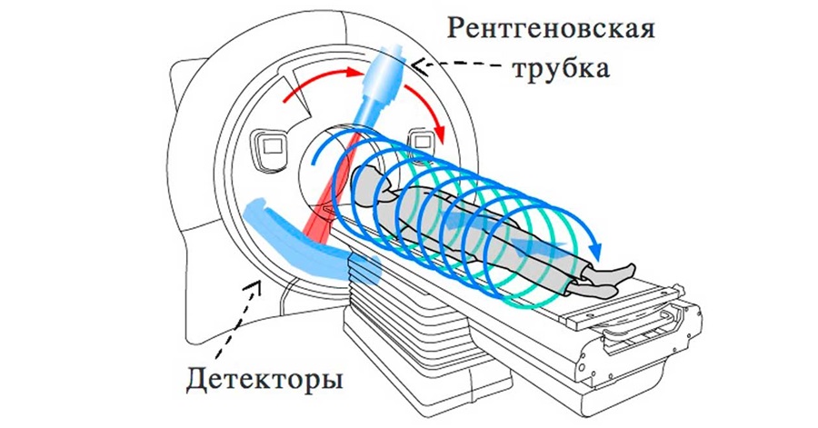 Схема работы компьютерного томографа