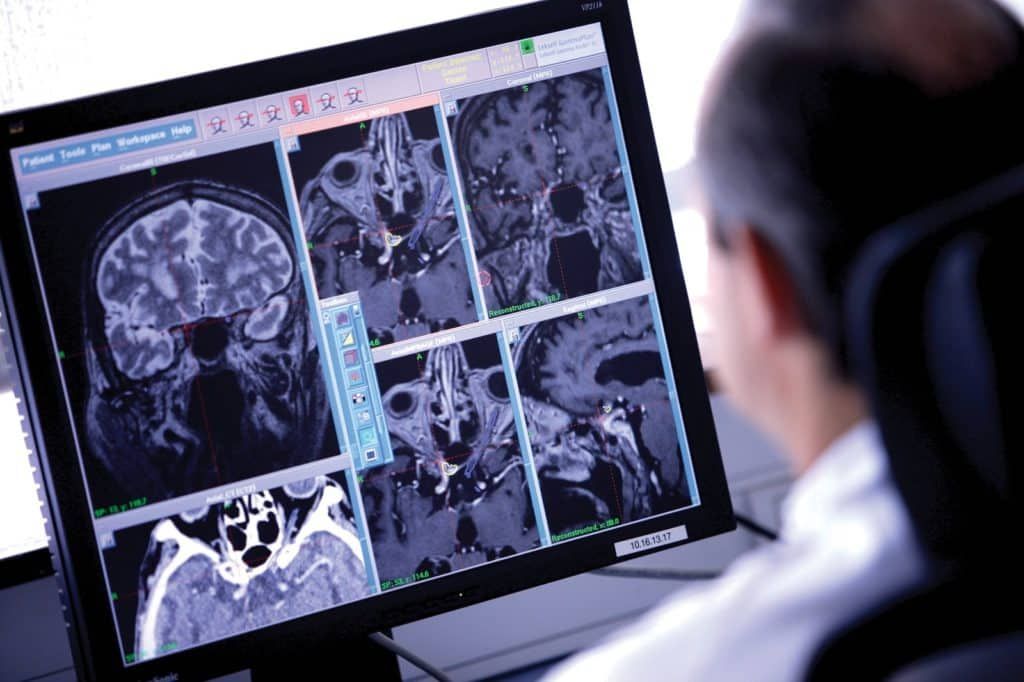 КТ головного мозга - поиск онкологии