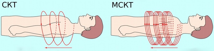 Схема сравнения СКТ и МСКТ