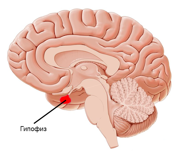 МРТ головного мозга и гипофиза - показания