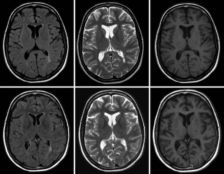 МРТ головного мозга в разных режимах