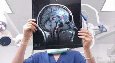 МРТ головного мозга, сосудов головы и шеи - расшифровка