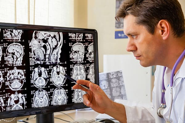 МРТ головного мозга и гипофиза - расшифровка