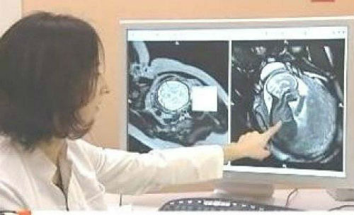МРТ головы беременным