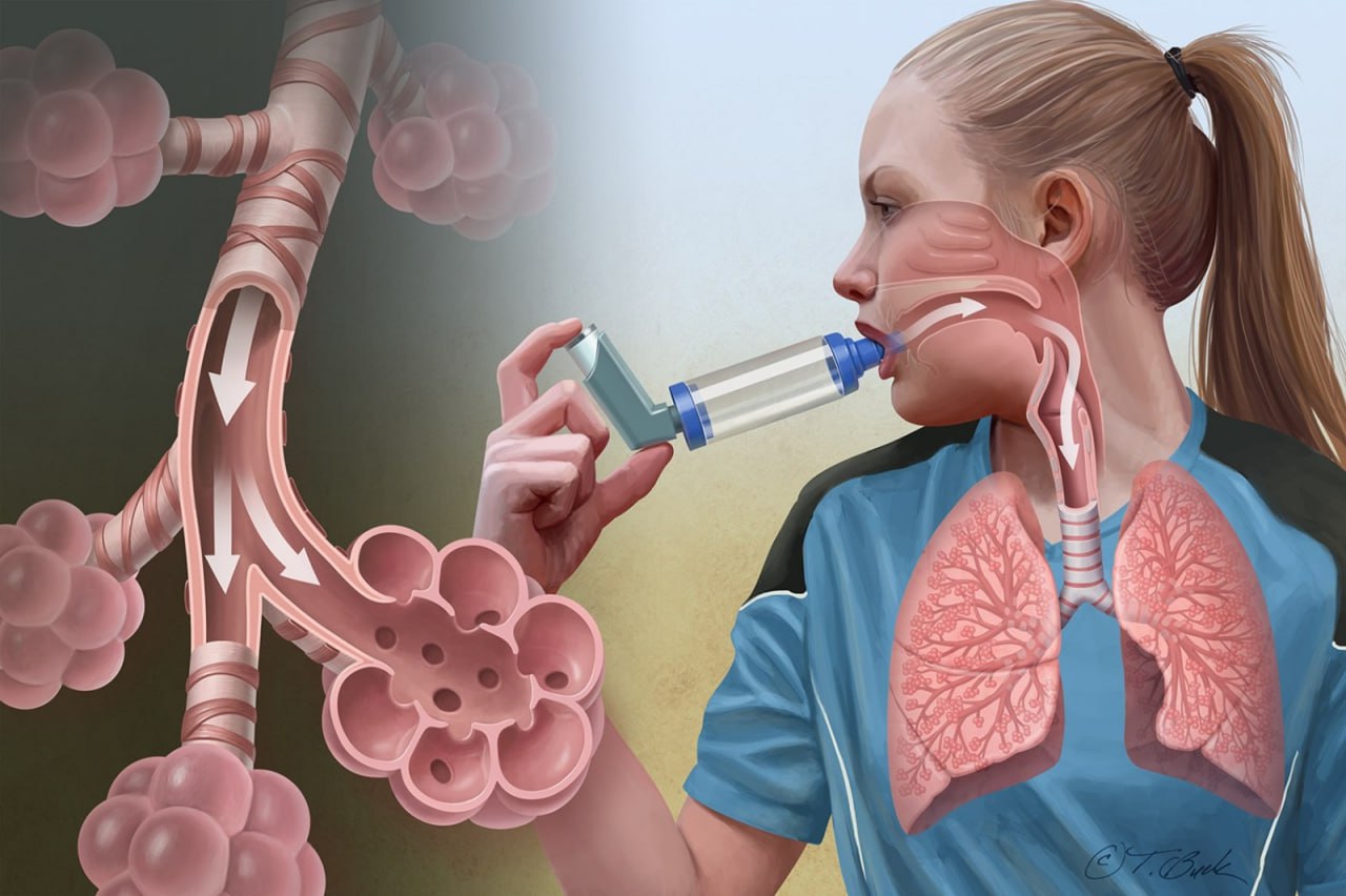 КТ сердца при бронхиальной астме - противопоказания