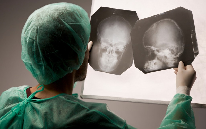 Рентген черепа - расшифровка результатов