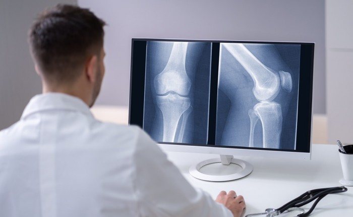 Рентген коленного сустава - расшифровка результатов
