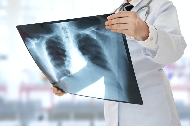 Рентген грудины - расшифровка результатов