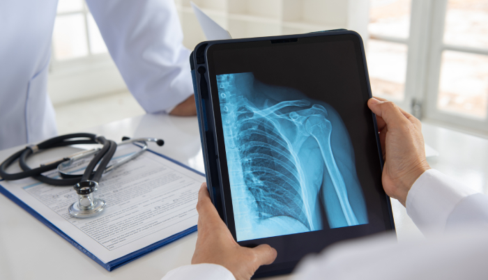 Рентген плечевого сустава - расшифровка результатов
