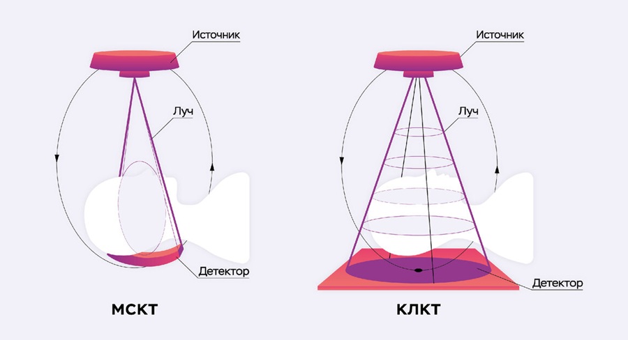 Схема сканирования МСКТ и КЛКТ.