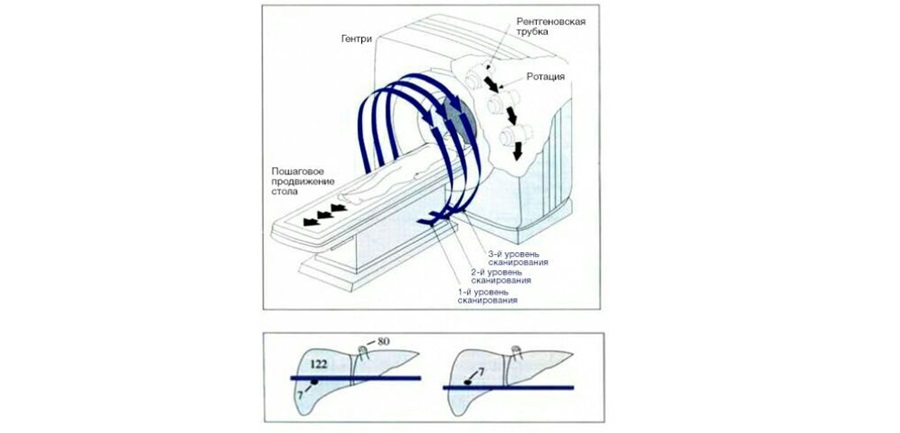 Традиционная компьютерная томография с пошаговым срезом