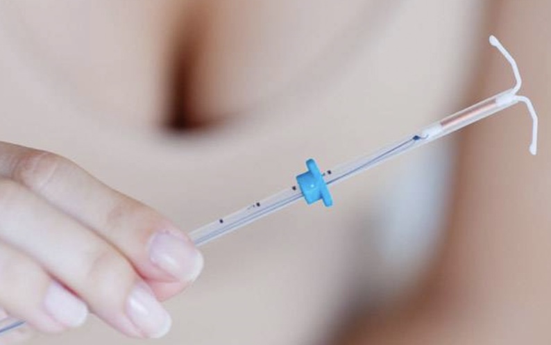 Внутриматочная спираль ВМС.